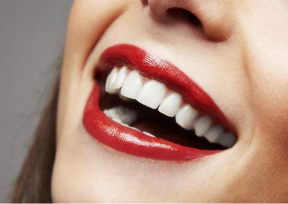 Saúde Bucal: dicas simples para ter dentes mais brancos (foto: internet)